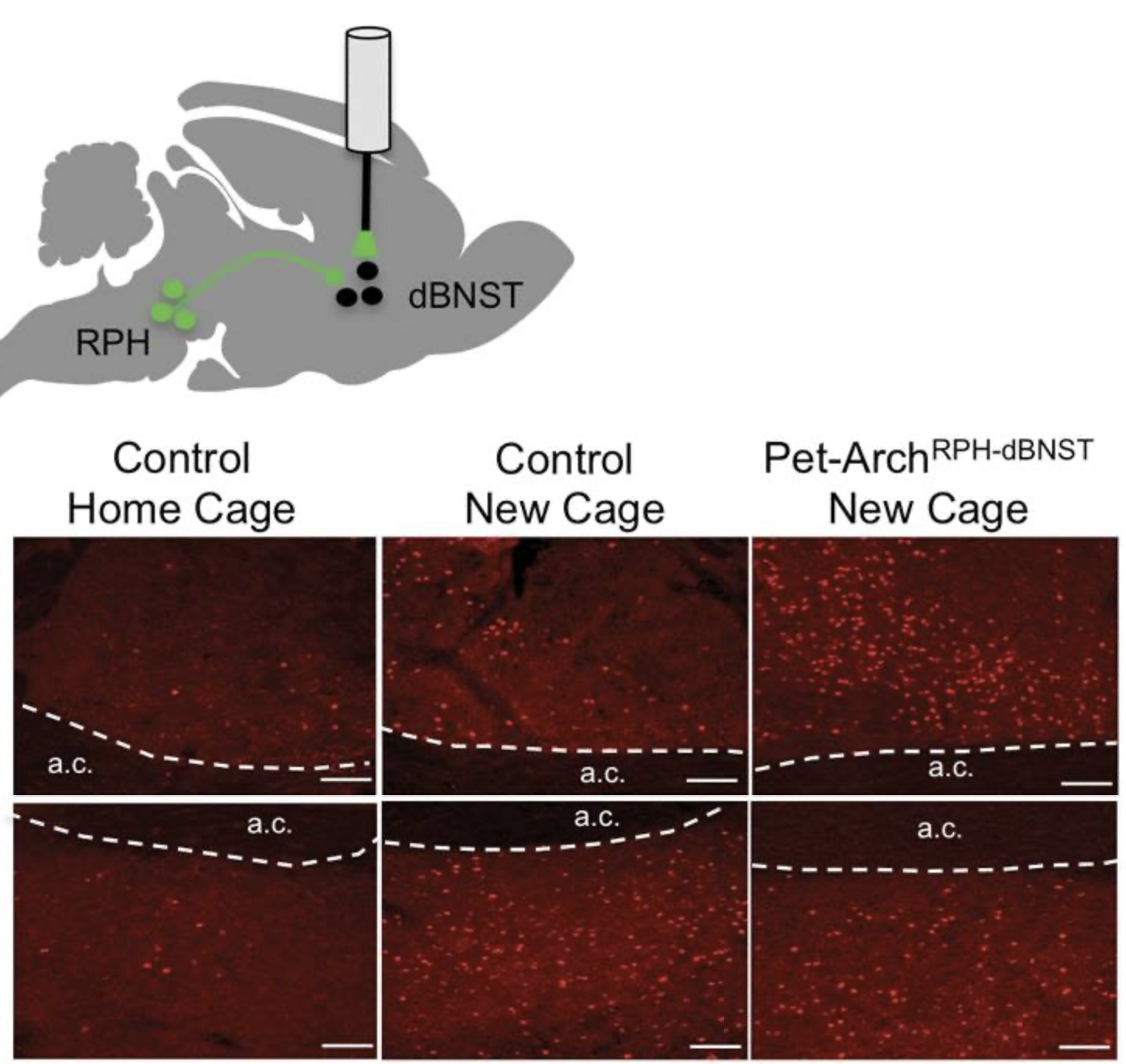 Serotonin inputs to the dorsal BNST modulate anxiety in a 5-HT1A receptor-dependent manner