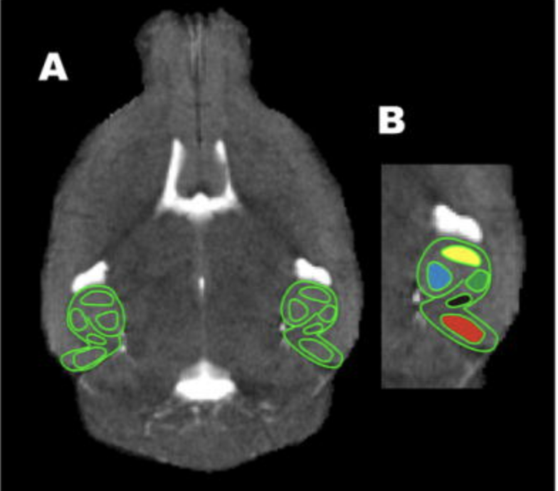 The absence of the calcium buffering protein calbindin is associated with faster age related decline in hippocampal metabolism